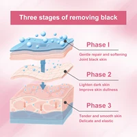 Crème blanchissante pour le corps, correcteur de taches foncées pour les aisselles, les genoux, l'intérieur des cuisses, éclaircissante, hydratante, pour zone intime, Lotion éclaircissante 4