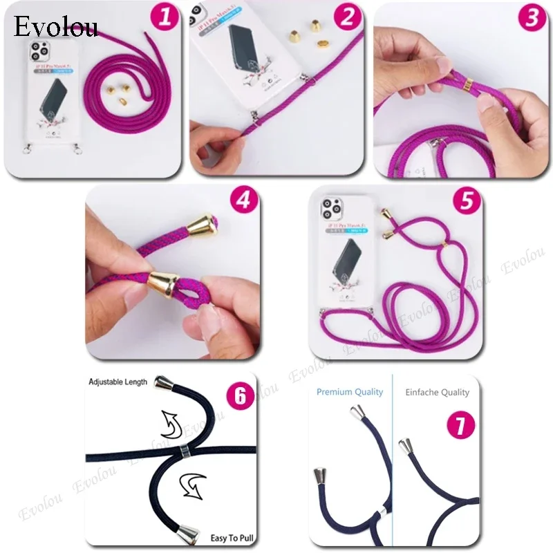 ل الشرف 400 الذكية Crossbody الحبل الرقبة حزام جراب هاتف ل الشرف X7D 4G 5G شفافة التدرج للصدمات الغطاء الخلفي