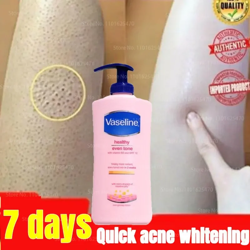 Vaseline Body Lotion for Men and Women Moisturizing Body Moisturizing Fragrance Brightening Skin Exfoliating Body Lotion 400ML