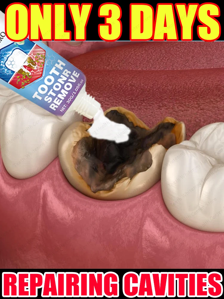 #24 New Dentures Arrivals