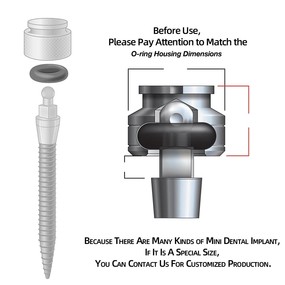 MDLMOR10Z MDLORZ Replacement O Ring Kit, for Intralock Mini Implant Metal Housing Maintenance