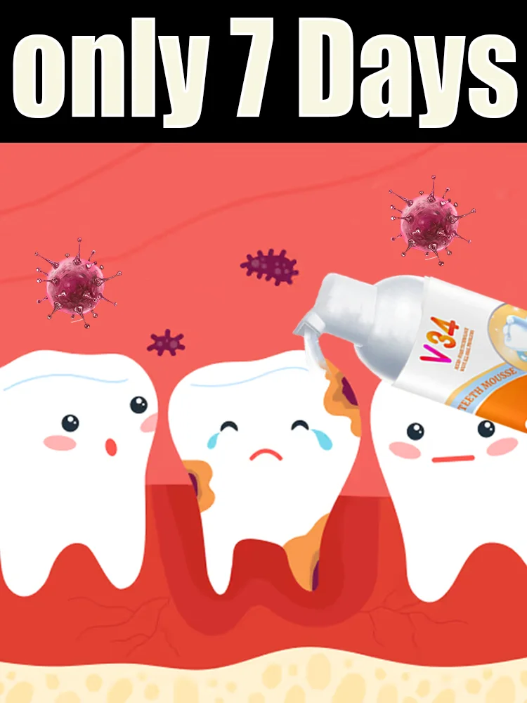 The second generation upgraded tooth protection mousse quickly repairs tooth roots