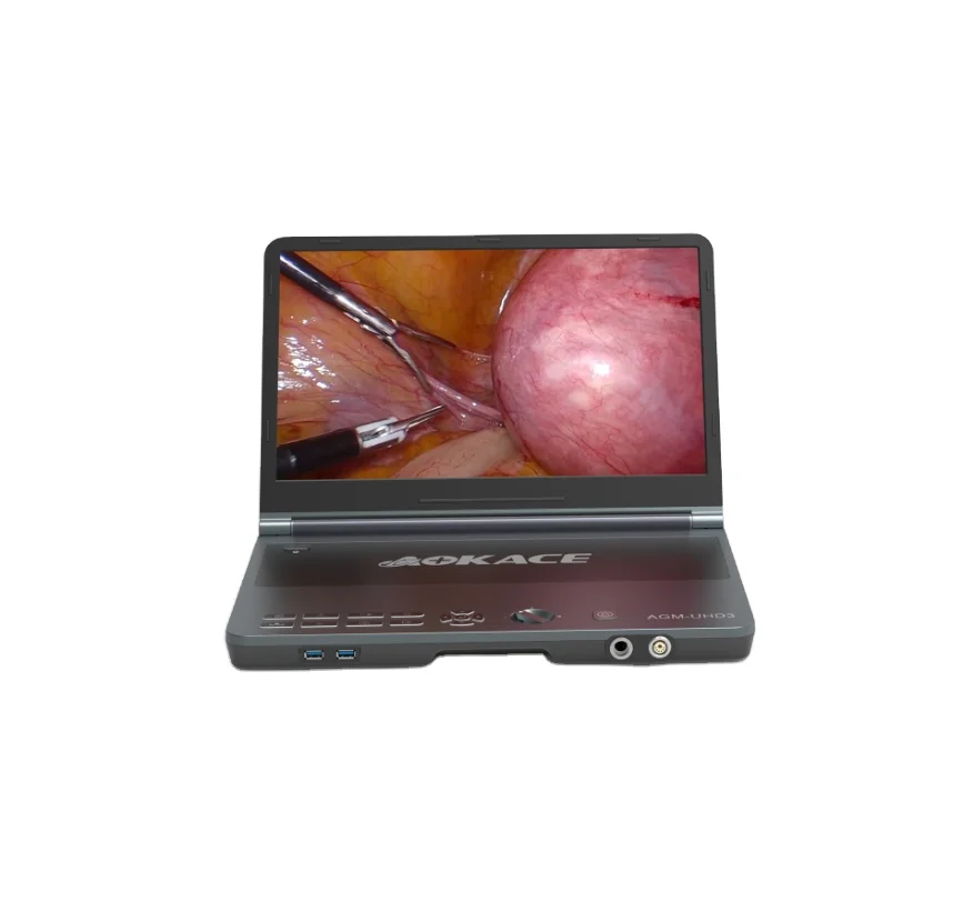 new product 4k medical UHD endoscope camera for laparoscopy all-in-one 4k camera system