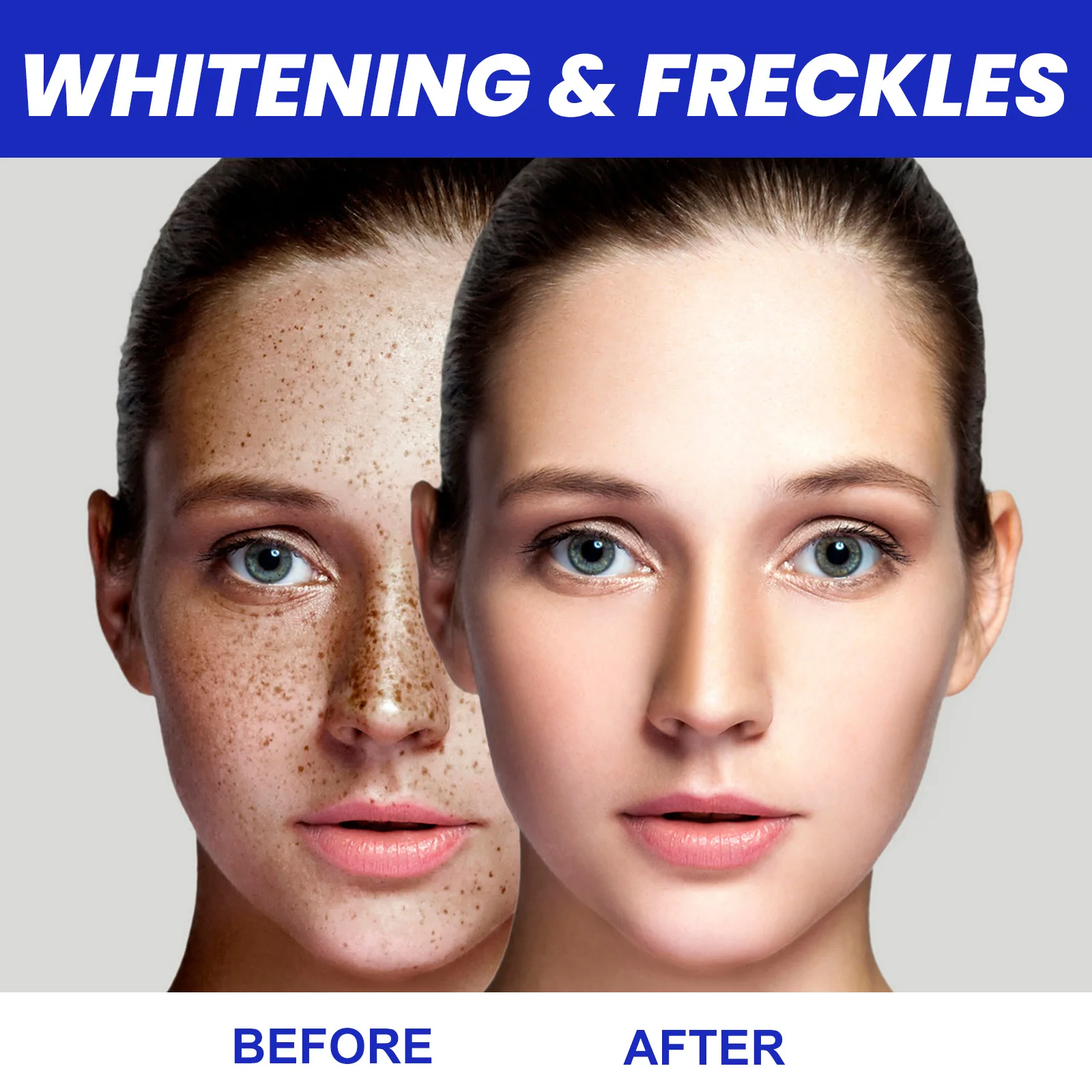 Dark Spot Whitening Serum Firming Advanced Moisturizing Brighten Skin Tone Remove Freckle Fade Melasma Nicotinamide Face Essence