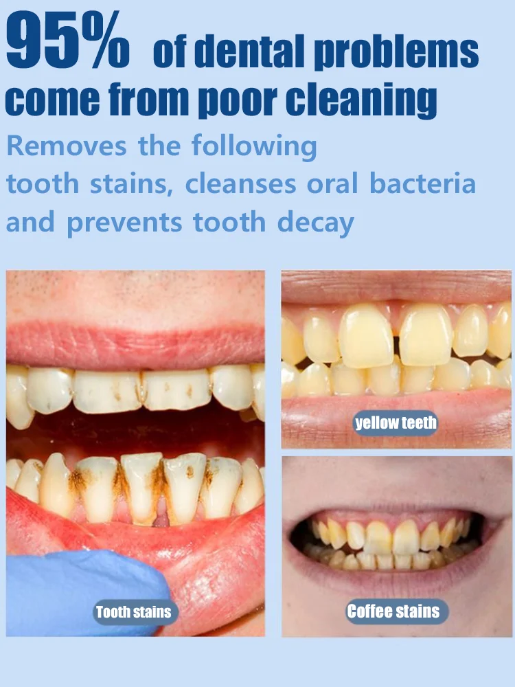 2025 waterproof intraoral repair patch, tooth correction patch, damaged and discolored intraoral care tool