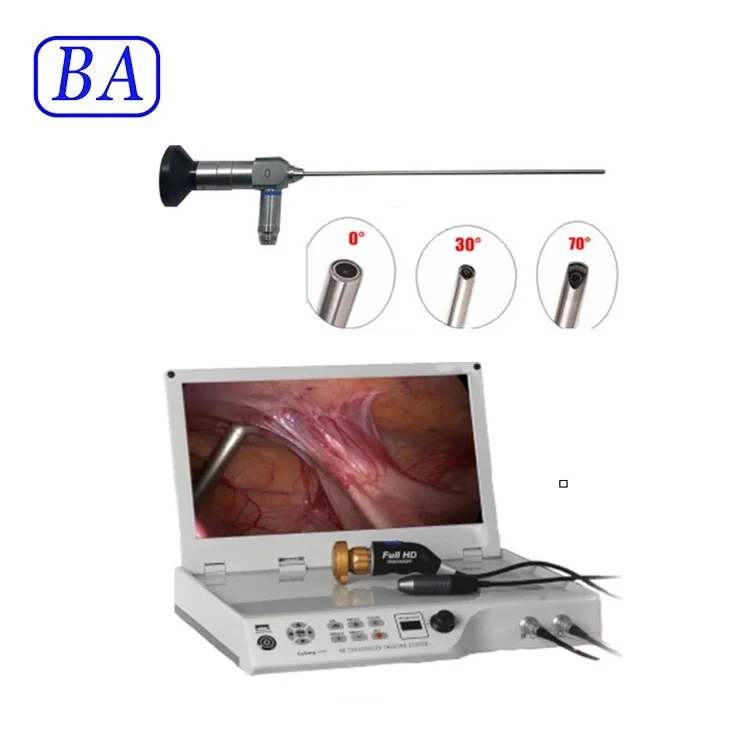 Surgical New Type CMOS portable endoscope ent unit