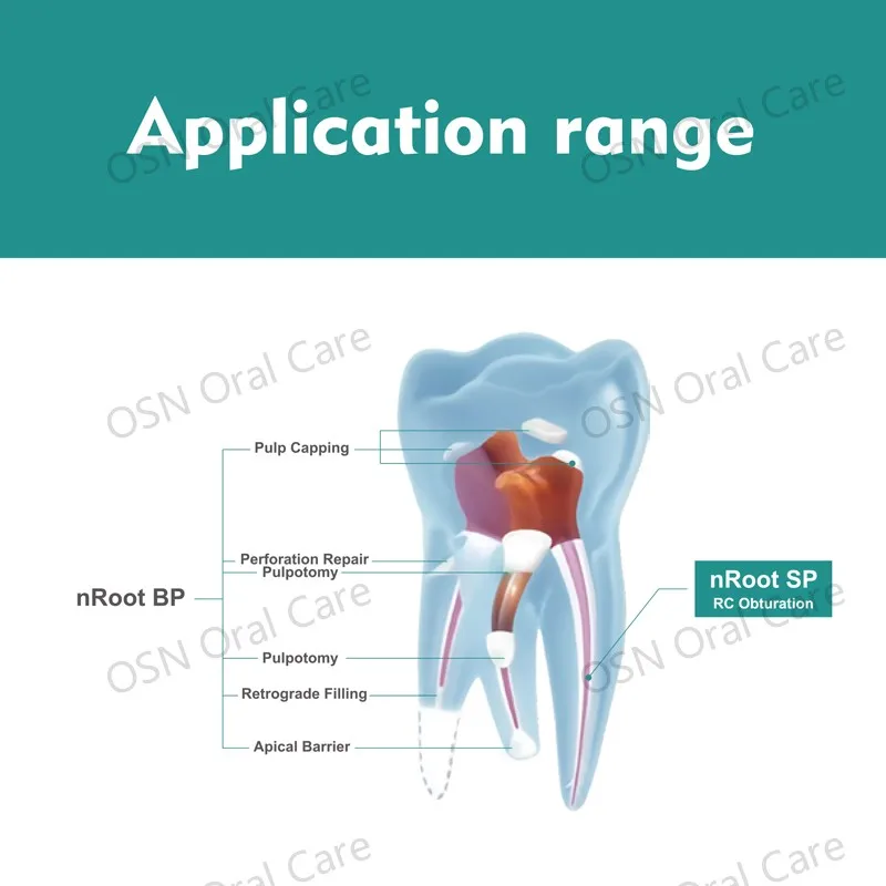 ENPUNUO nRoot BP Oral Antibacterial Paste 0.5g Pre-Mixed Bioceramic Root Canal Repair Dental Material