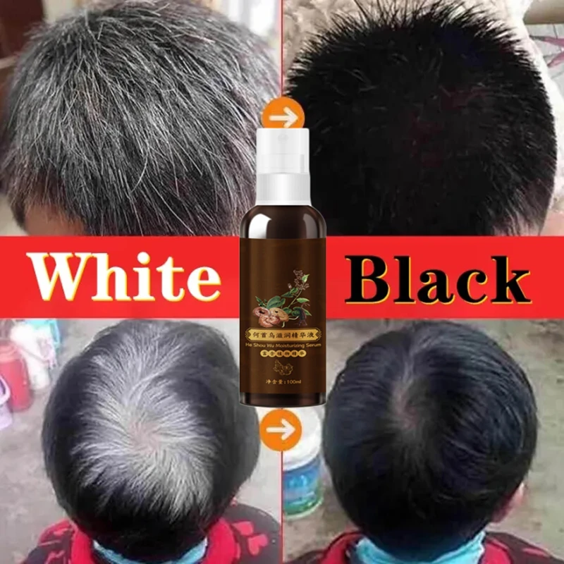 100ml Polygonum Multiflorum Natural Black Hair Serum Dyeing Spray Gray Hair Coloring Shampoo White Hair To Black Promote Beauty