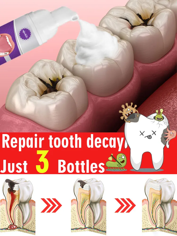 Solves caries and tooth decay problem