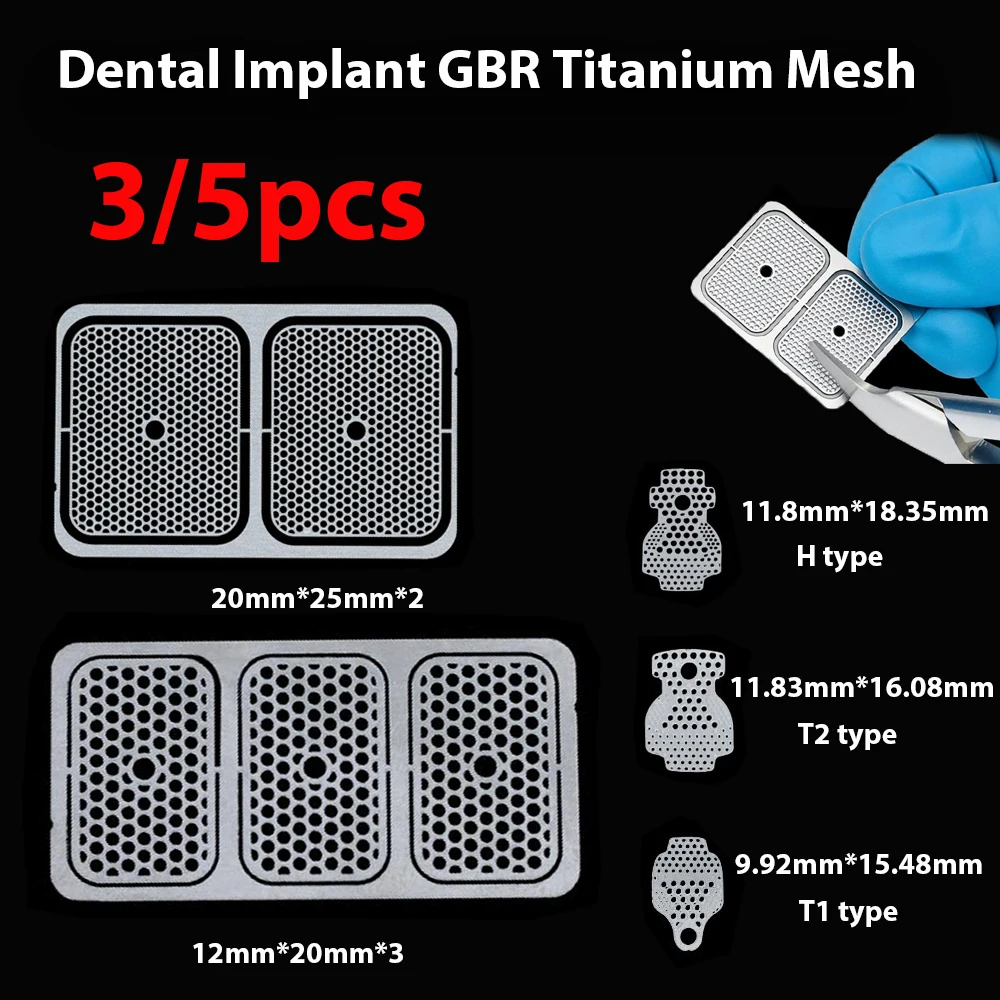 Flexible GBR Titanium Mesh Kit – Dental Bone Regeneration with Fixation Nails, Implant Site & Sidewall Augmentation Plates