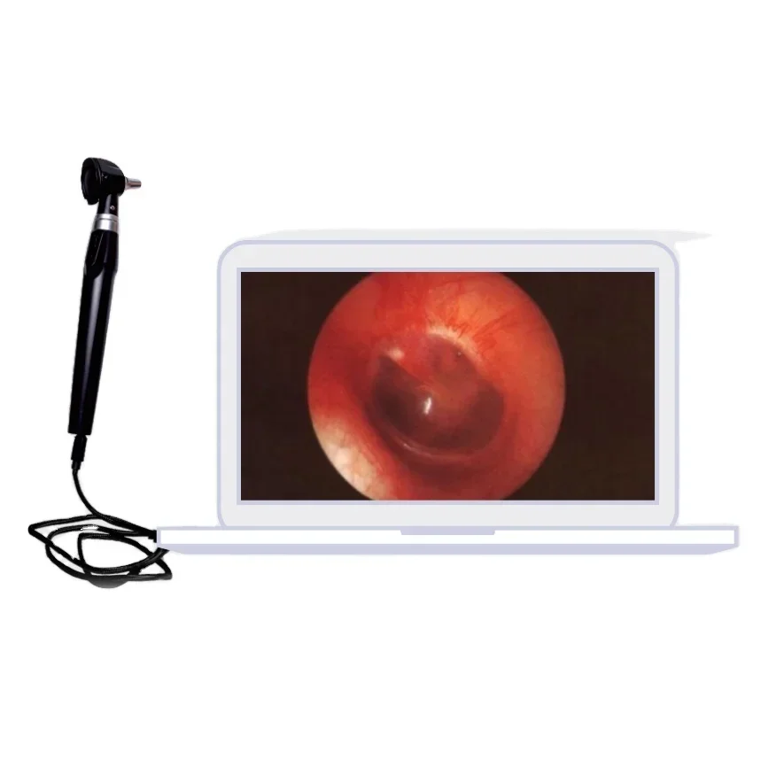 

SZMIQU Video otoscope ENT Diagnostic Sets otoscope with usb connect Computers and Android phones