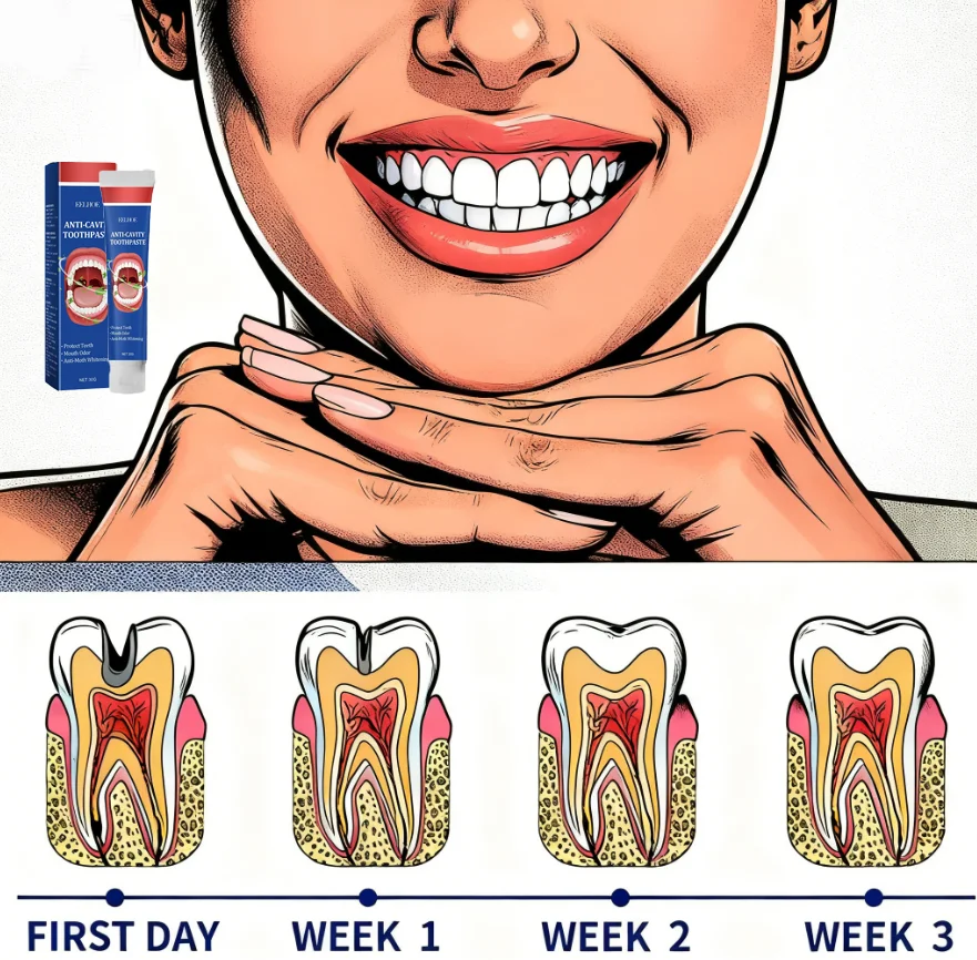 Gum Repair Toothpaste Relieves Tooth Allergies and Cavities Tooth Cleaning Toothpaste Prevent Tooth Damage