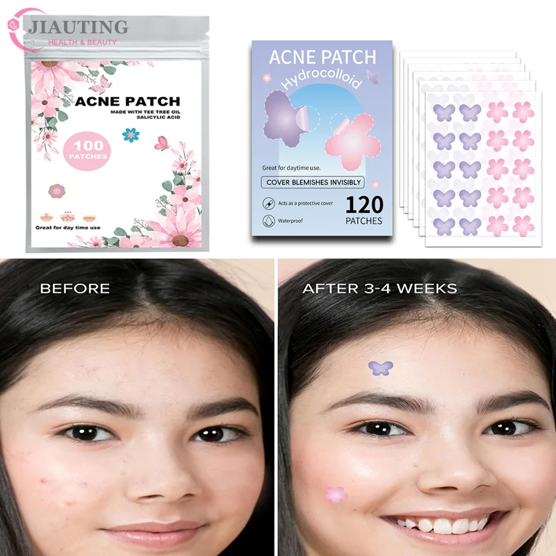 100/120PC Patch สิวดอกไม้สิว Patch สิวที่มองไม่เห็นกําจัดสิว Skin Care สติกเกอร์คอนซีลเลอร์ Face Spot เครื่องมือแต่งหน้าความงาม