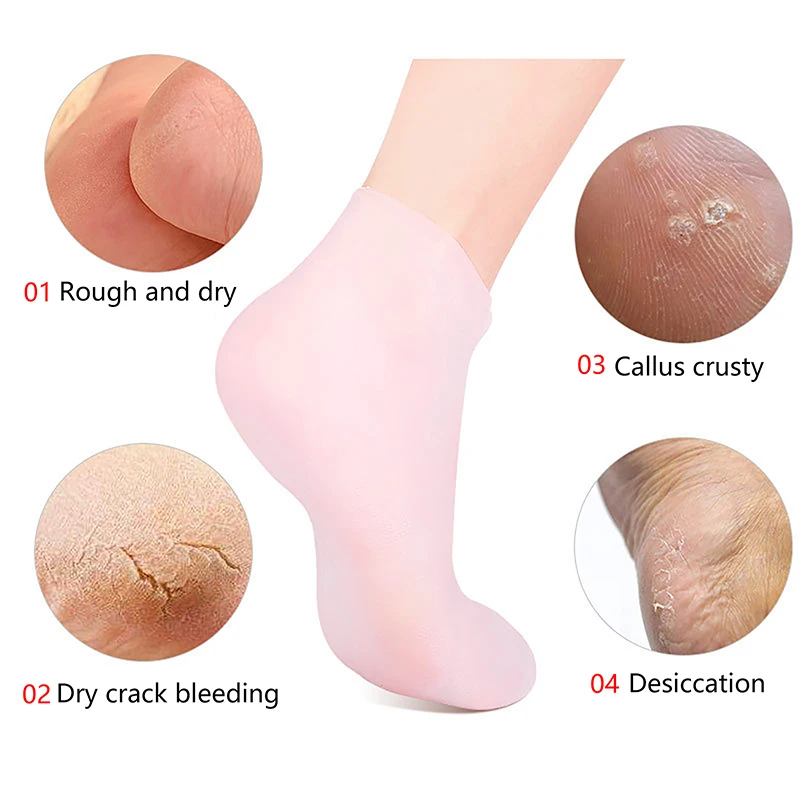 2 pçs meias de silicone cuidados com os pés anti rachaduras hidratante gel meias rachadas pele morta remover protetor alívio da dor ferramentas pedicure