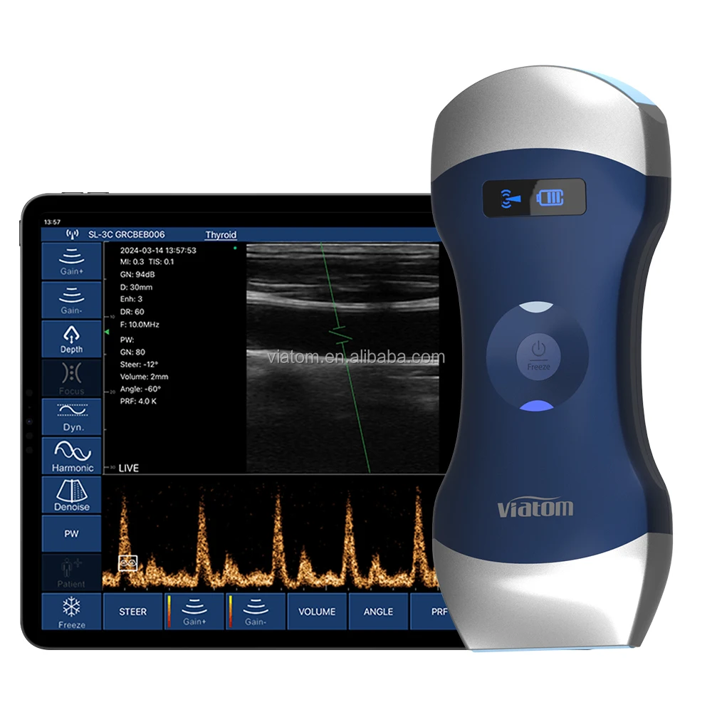 الموجات فوق الصوتية قبل الولادة يقيس الصحة الشاملة والنمو وتنمية الجنين