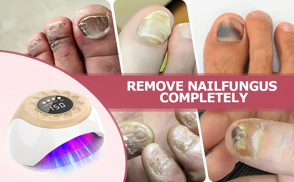 

1/2/4 Pcs Nail Fungus Light Device for Toenails and Fingernails