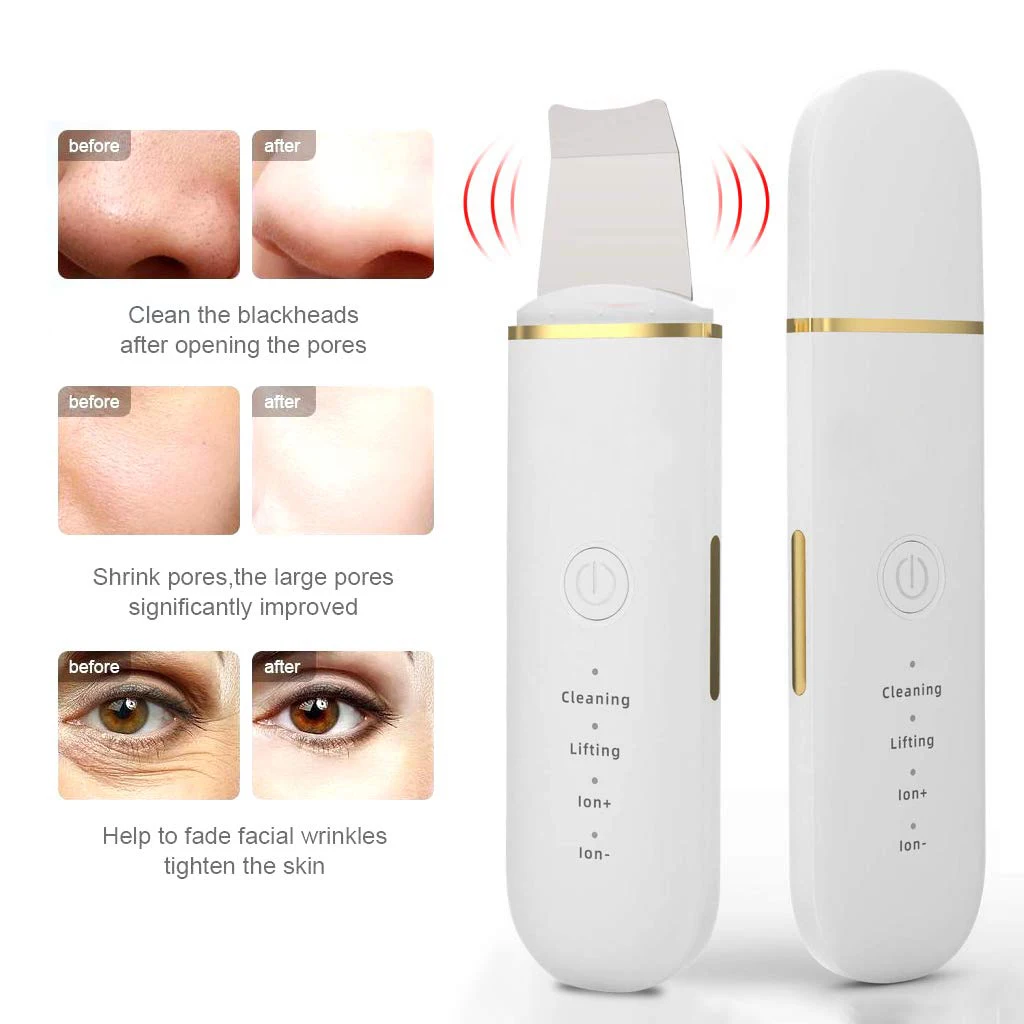 Ultrasonic Skin Scrubber EMS Ion Import Facial Lifting Vibration Massager Deep Face Pore Cleansing Blackhead Remover Tool