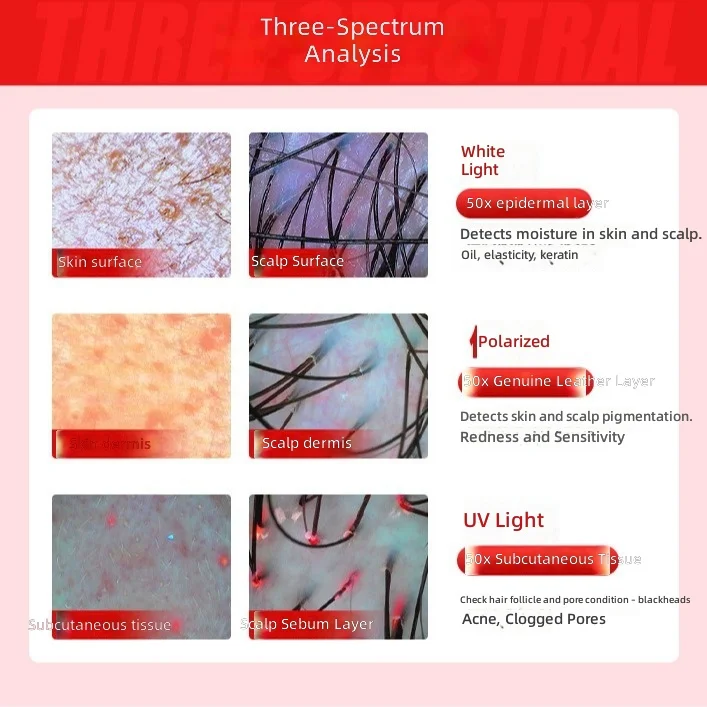 Professional Skin & Scalp Analyzer for Beauty Salon, Follicle & Facial Skin Tester, Dermatoscope Device, Hair Health Monitor