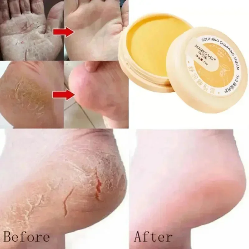 Anti Drying Cracking Foot Cream Heel Cracked Repair Oil Removal Calluses Dead Skin Anti Chapping Moisturize Hand Foot Skin Care