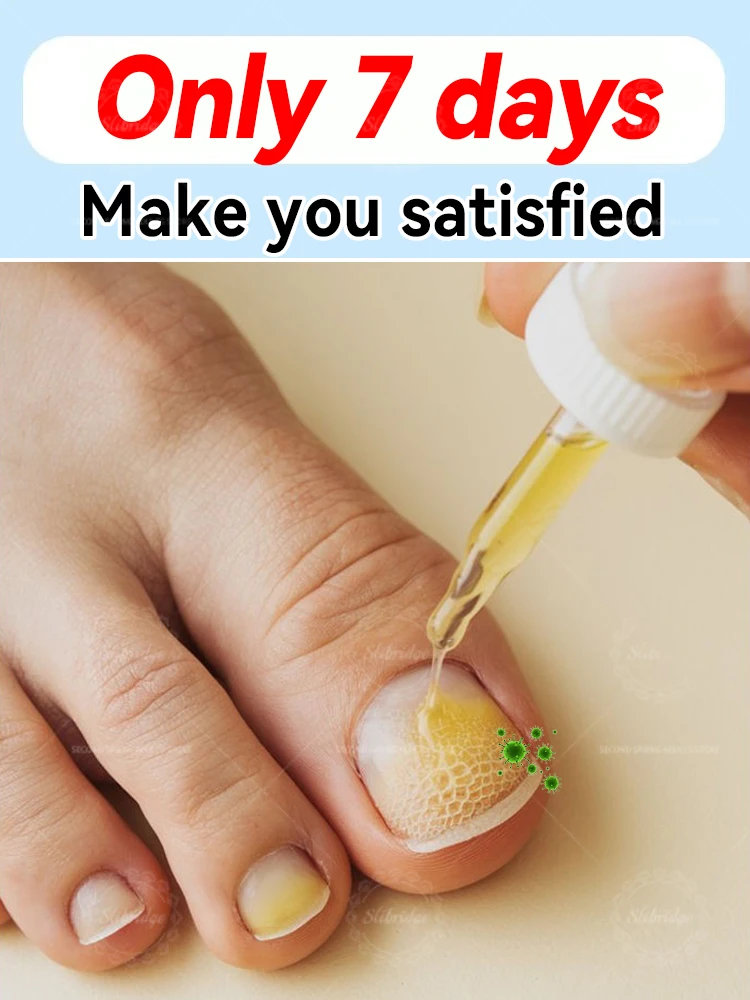 manicure voor slecht Kan in 7-dagen afscheid Geschikt voor alle leeftijden