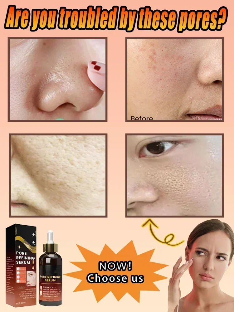 Soro de encolhimento de poros, remoção facial de poros grandes, reparação de poros faciais, minimização de essência, óleo firme, cuidados de beleza da pele