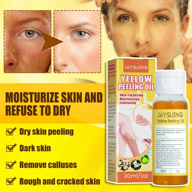 Exfoliating Yellow Skin Oil Moisturizes Removal Chicken Skin Delicates Skin Repair Brightens Yellow Improve Dry Body Care Oil