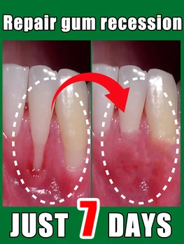 Naprawiają zniszczone dziąsła, łagodzą ból dziąseł, wzmacniające dziąsła i przywracają zdrowe dziąsła