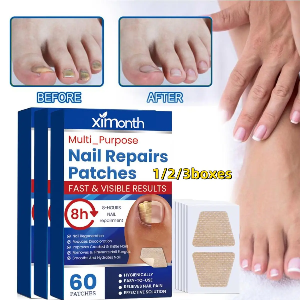 1/2/3boxes Toenail Fungus Treatment Stickers Ingrowning Toenail Corrector Paronychia Treatment Fungus Removal Nail Repair Patch