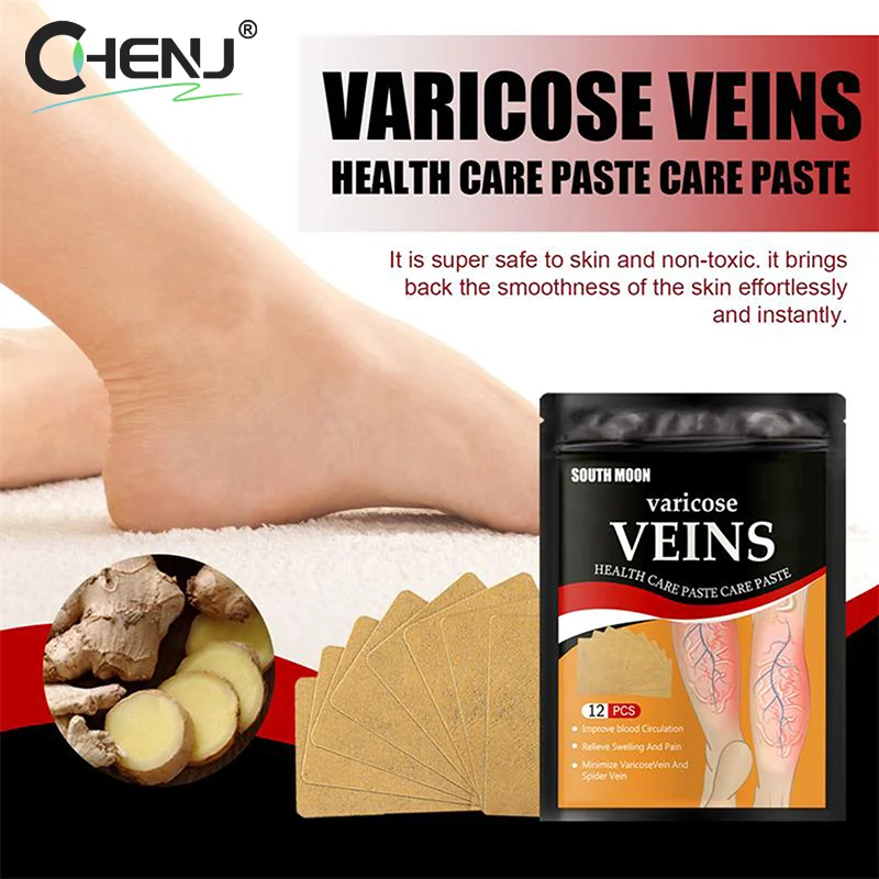 12PCS Unisex Varicose Veins Treatment Patch Legs Sore Swelling Plaster Promote Metabolism Promote Smooth Blood Circulation