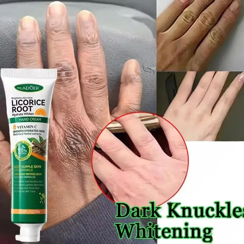 

Fast Whitening Dark Knuckles Brighten Hand Cream Melanin Corrector Moisturizing Intense Stains Remover Products Skin Care