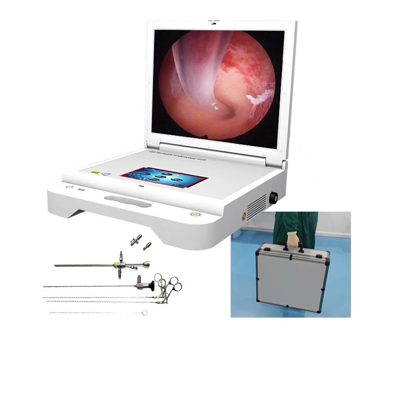 All-in-one pc equipo medico histeroscopio portatil endoscope camera unit with histeroscopio instrument