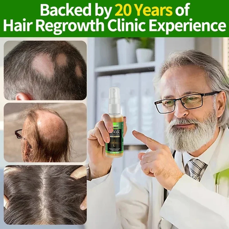 Óleo essencial de gengibre para o crescimento do cabelo, essência anti-perda, reparação do couro cabeludo, danos, crescer, nutriir, couro cabeludo,