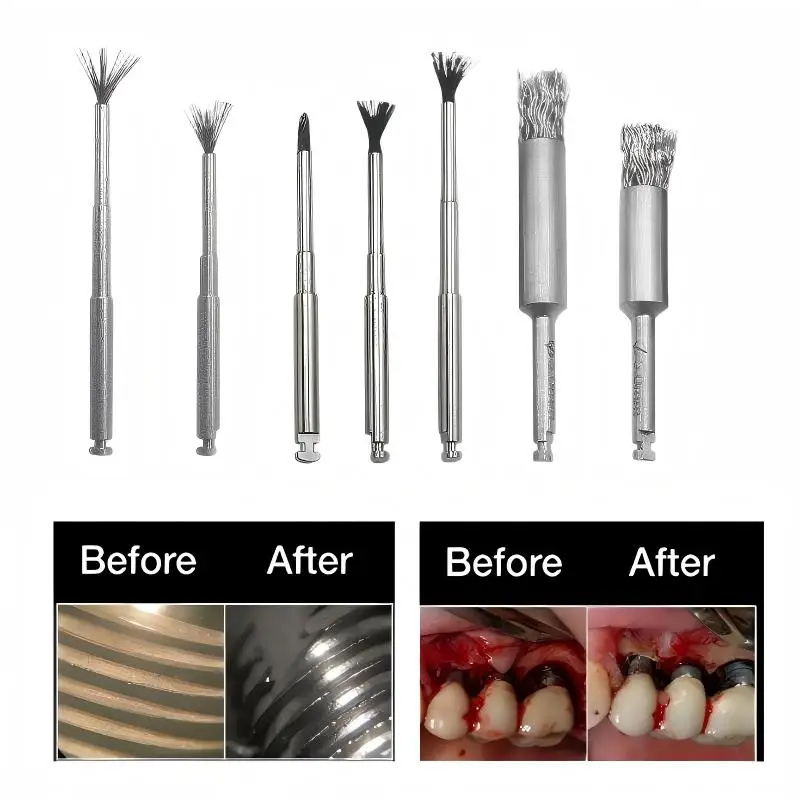 Precision Dental Titanium and Stainless Steel Wire Brushes for Implant Maintenance Cleaning and Surface Care Procedures