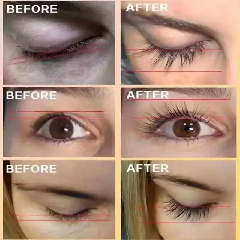 Eyebrow Eyelash Growth Serum Fast Growing ป้องกันผมร่วงเสีย Treatment ป้องกันหัวล้าน Fuller หนา Eye Care แต่งหน้า