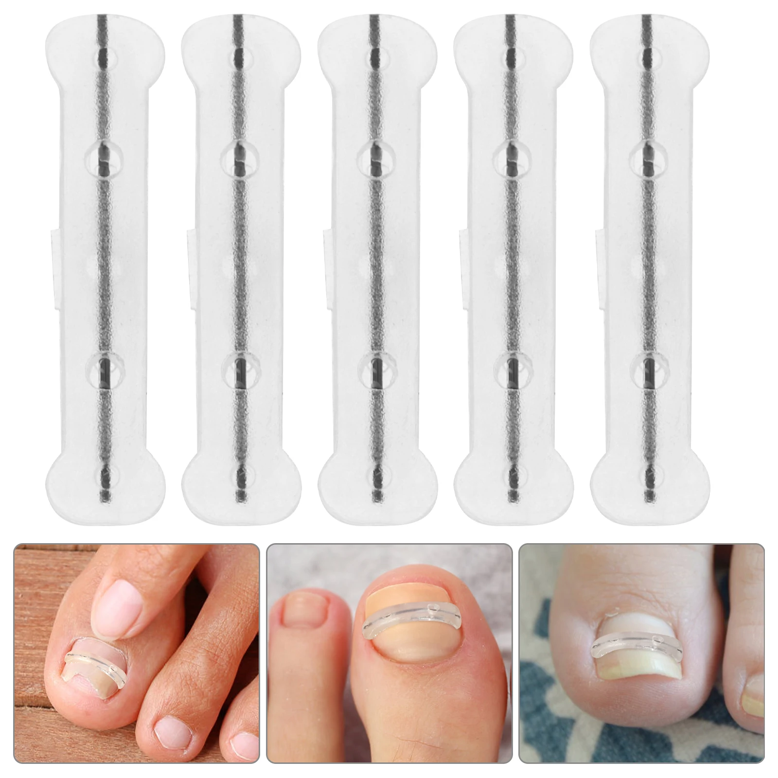 10PCS Household Nail Stickers Ingrown Toenail Titanium Alloy Silica Gel Daily Tool Treatment Memory Nail Stickers Silicone