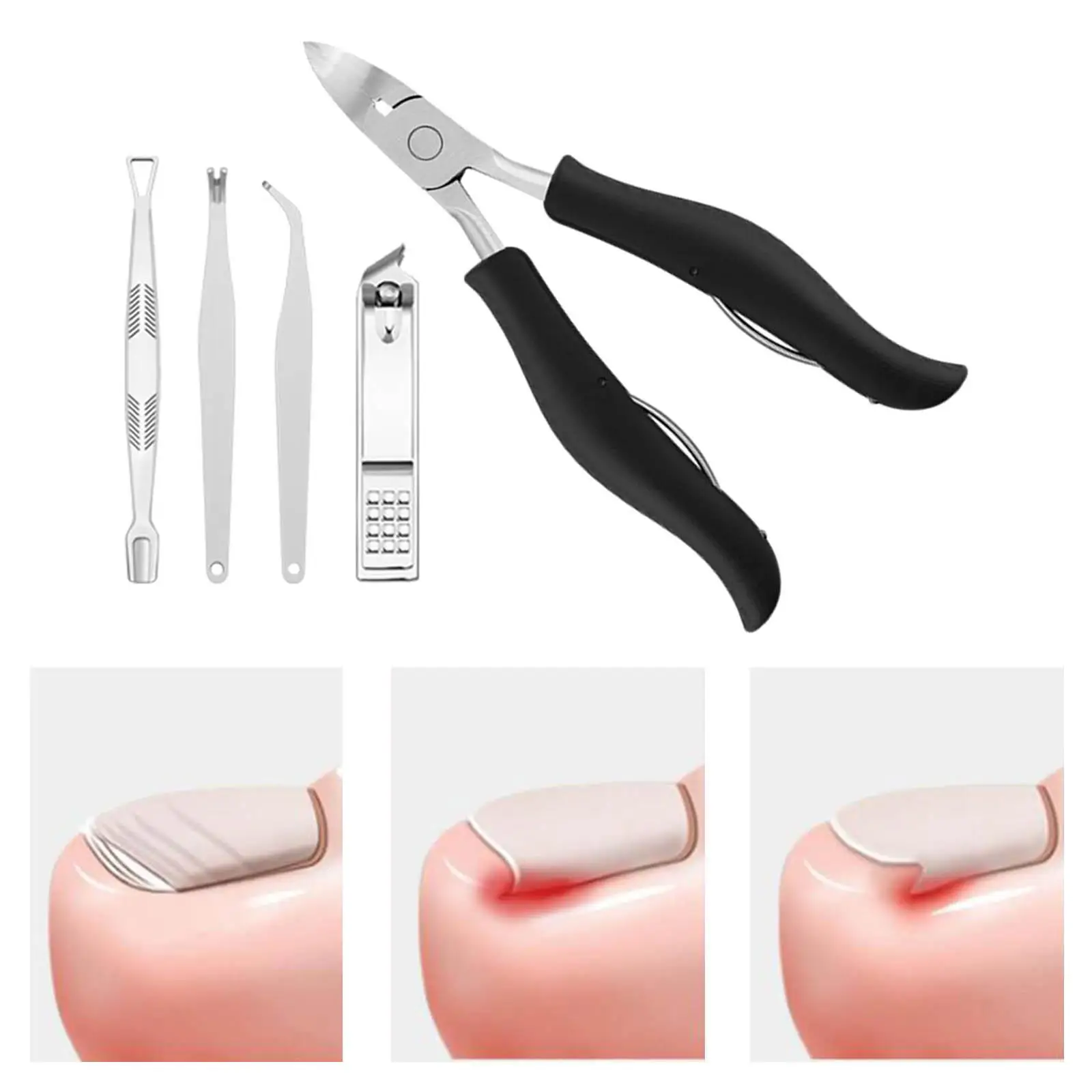 Coupe-ongles pour orteils, Correction des ongles, en acier inoxydable, pour ongles incarnés épais