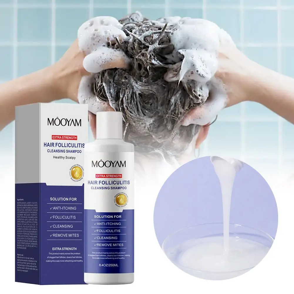 250 مللي شامبو إزالة القمل العث القشرة الحكة النفط تنظيف فروة الرأس الشعر العميق بصيلات مضادة للحكة تنظيف العناية بالشعر