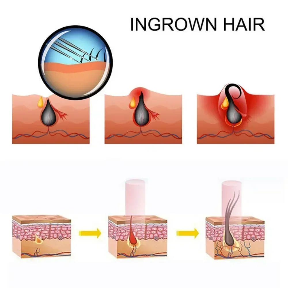 USB recarregável Anti-Hair Loss Infrared Light Cap, Luz vermelha LED, Tratamento do crescimento do cabelo, Promover o cuidado do crescimento do cabelo