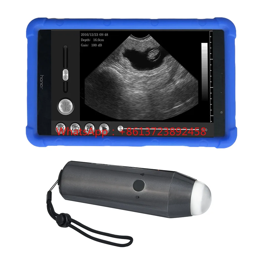 

Portable 128 Elements Wireless WIFI Pigs Goats Sheep Pregnancy Ultrasound Wireless Convex Probe