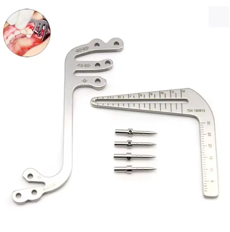 

1 комплект стоматологических сверхгибальных скалорующих направляющих, направляющих для имплантатов, направляющих для позиционирования имплантатов и руководства для позиционирования имплантатов.