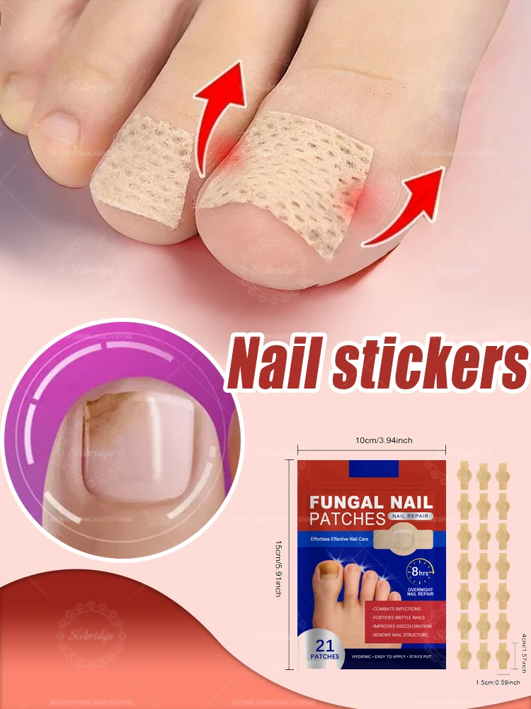 손톱 수리 패치 발톱 곰팡이 패치 끈적한 발톱 관리 손톱 자란 교정 스티커 손발톱증 치료 패치