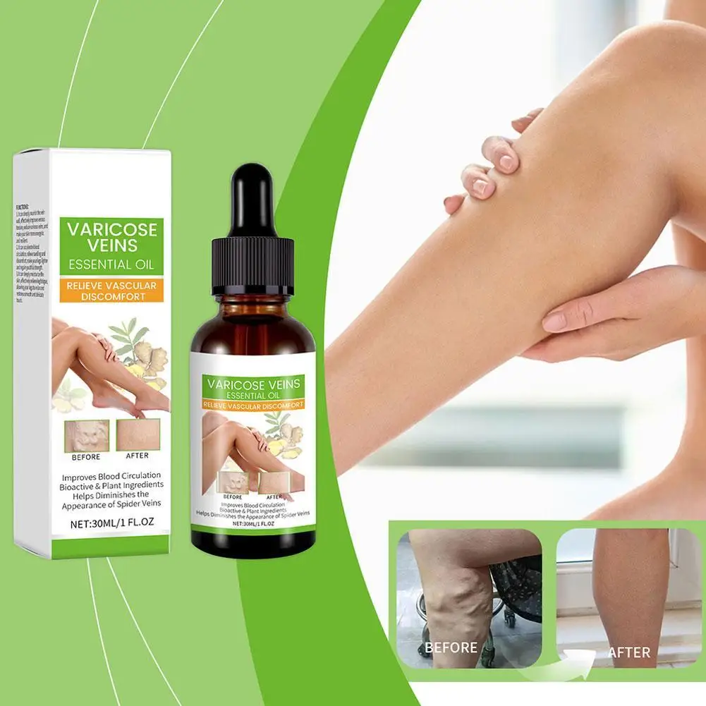 30ml Repair Vein Damage Essential Oil Varicose Veins Hardening Regulating Leg Health Care Essence Moisturizing Massage Oil