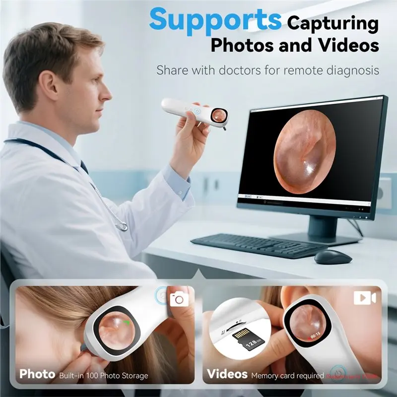 ABAG 1080P HD Otoscopio visivo digitale per orecchio 1.21 pollici Smart Visual Ear Wax Strumento pulito Supporto per scattare foto e video per l'orecchio del naso