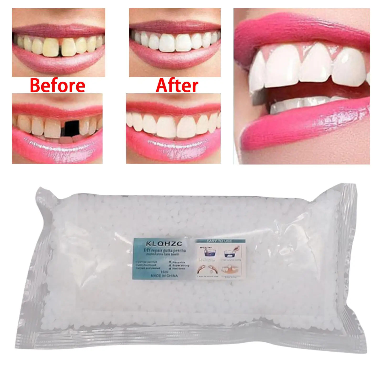 Teeth Repair Kit 100G Teeth Replacement Kit Moldable False Teeth Thermal Fitting Beads Filling The Missing Broken Tooth Safe