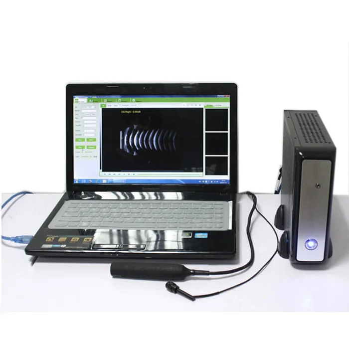 CAS-2000B+ China Ophthalmic Ultrasound a AB Ecobiometry Scanner Ophthalmology AB Scan