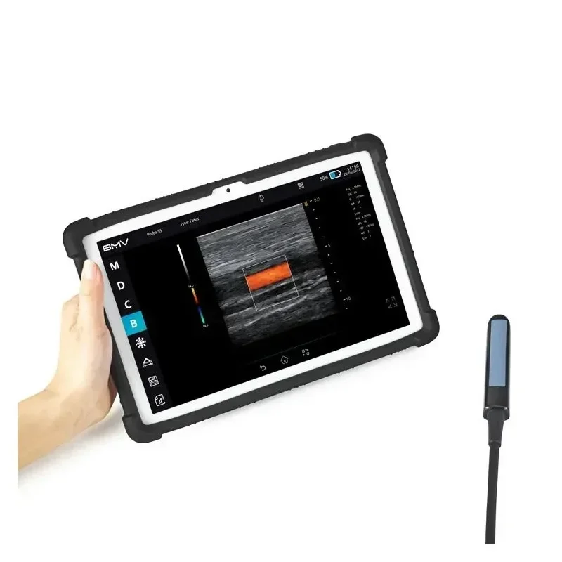 S5 Plus Color Doppler USB Wireless Ultrasound Scanner Veterinary Portable Ultrasound For Bovine Equine With Rectal Probes