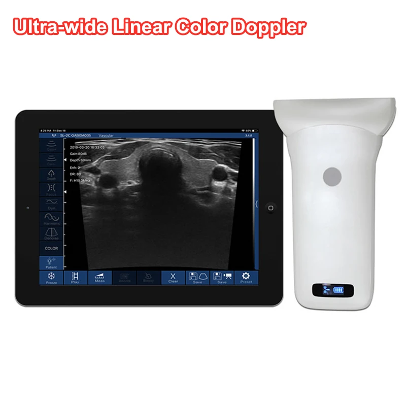 8cm 256Elements Ultra-wide Palm Color Doppler Wireless Ultrasound Linear Probe For Breast Hip Bone