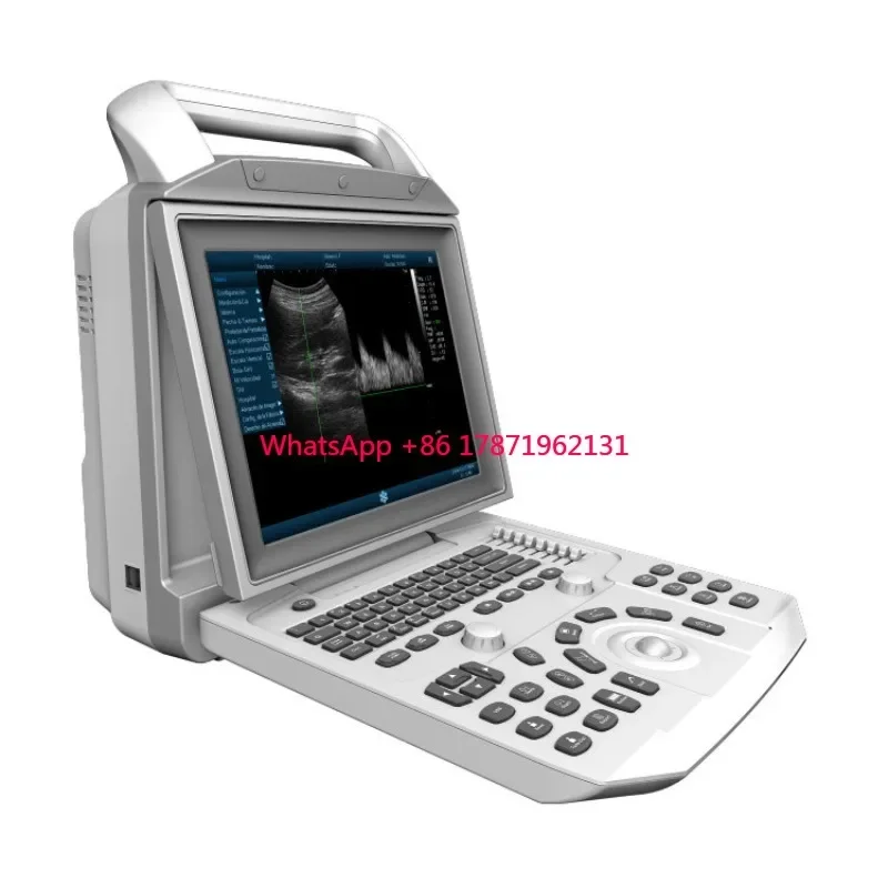 Diagnosis System Medical Ultrasound Scanner Medical Ultrasound Instruments Black And White Trolley Hospital Ultrasound