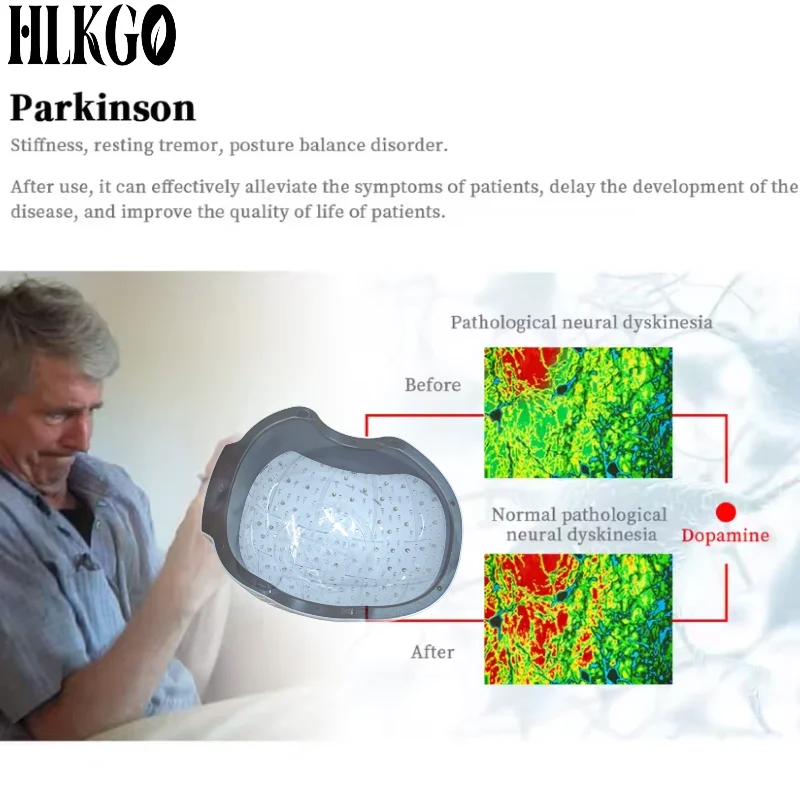 Neuromodulation Therapy Helmet 810nm NIR Light 400Hz Brain Wave for Depression Anxiety Parkinson Home Use Insomnia Relief Device