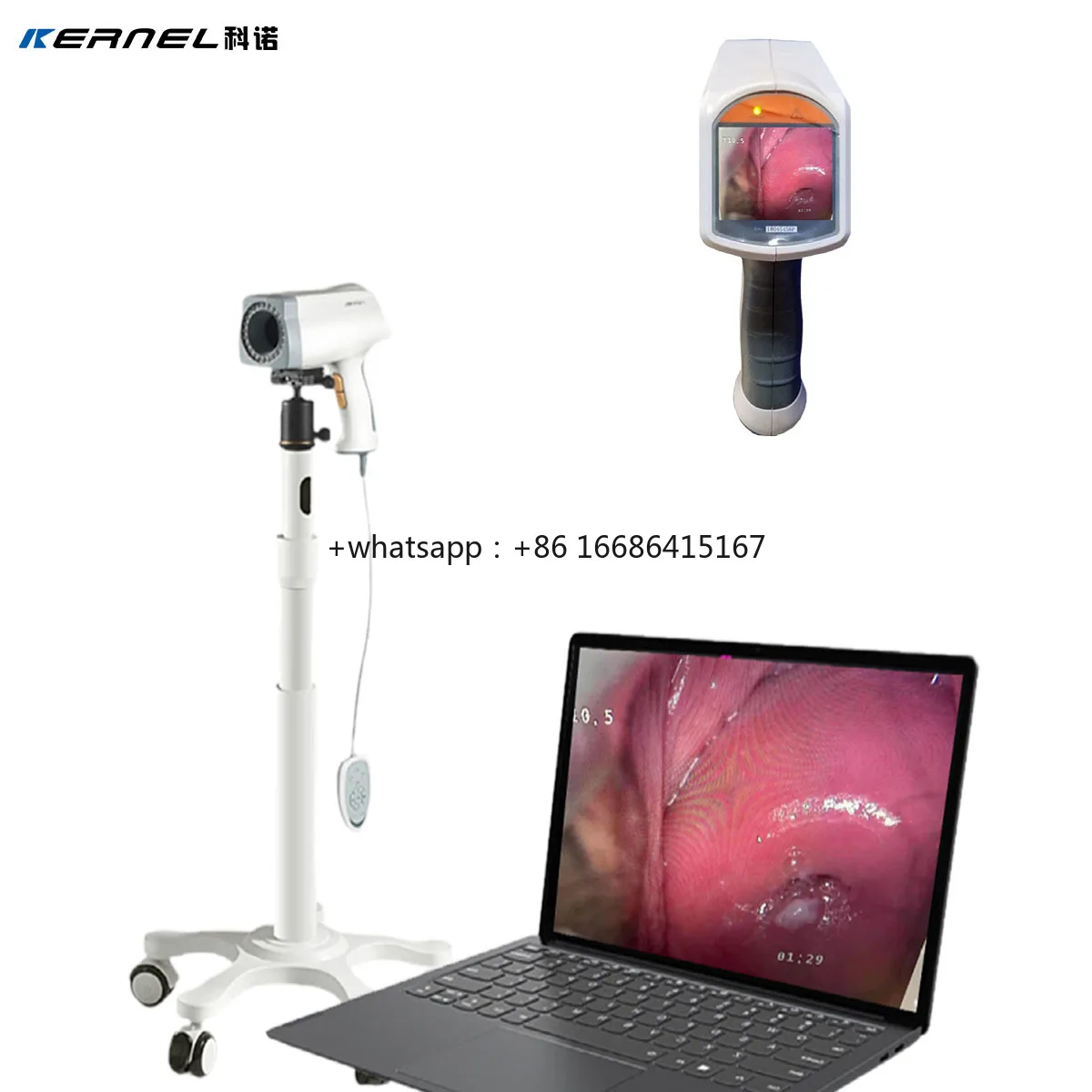 

China Digital Manufacturer With OEM Service Gynecology Machine For Clinical Application Kernel KN-2200